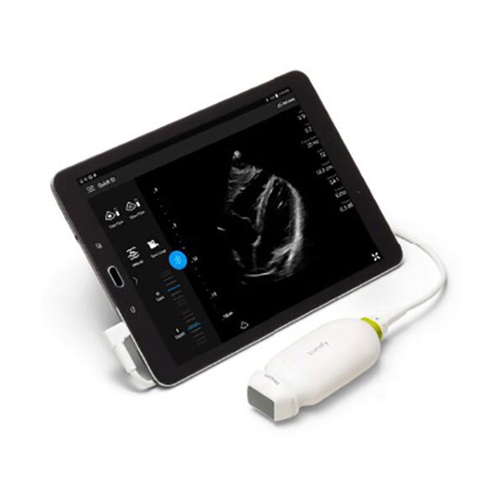at home sonogram with a smartphone