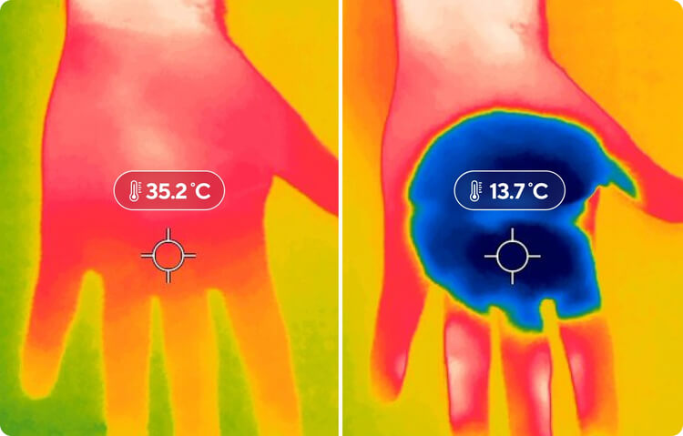 Infrared hand diagram